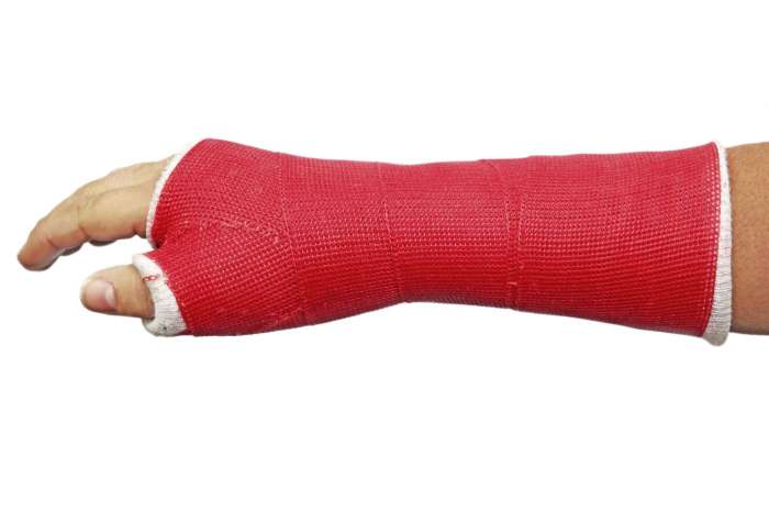 Air Cast For Fracture Wrist Cast of home improvement